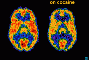 bộ não cocaine